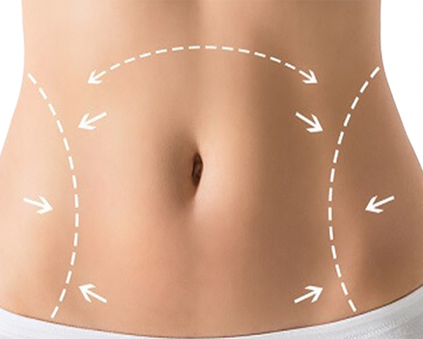 abdominoplastia dr vitor ferraz cirurgia plastica em goiania